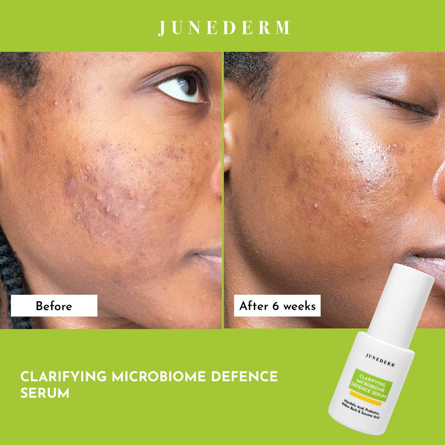 Clarifying Microbiome Defence Serum