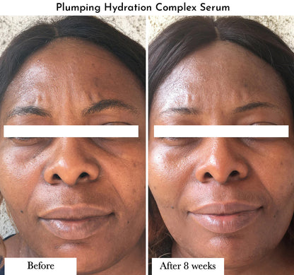 Plumping Hydration Complex Serum